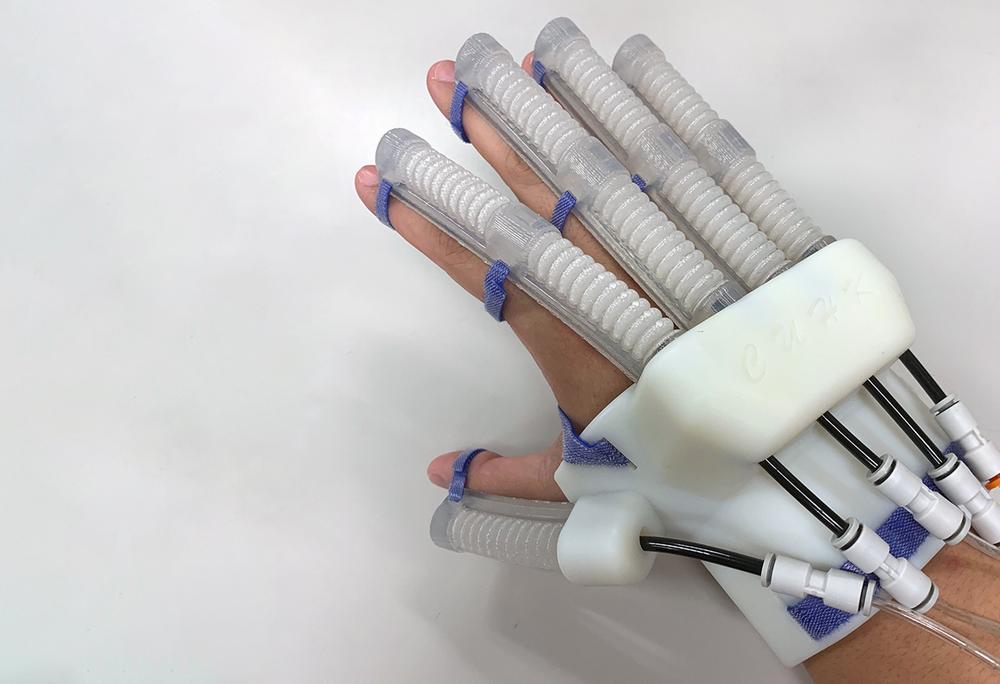 This image shows a white Cyton Gamma 3D printed exoskeleton glove.